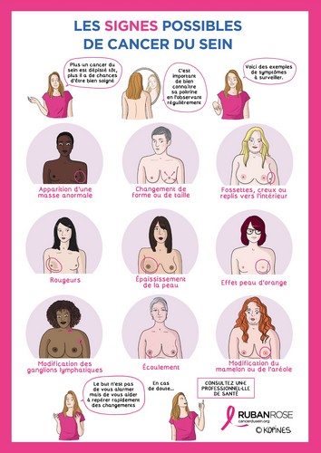 Signes possibles de cancer du sein